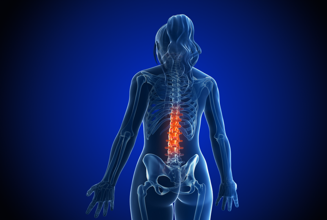 Estrogen and low back pain: what the research shows
